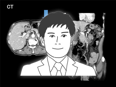 第10回　腹腔鏡補助下横行結腸切除術（Laparoscope assisted partial resection of the transverse colon）