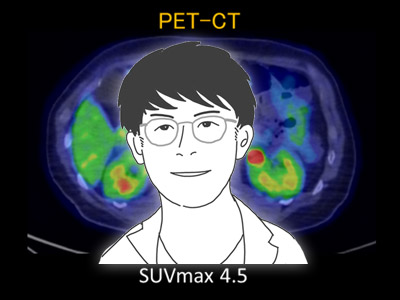 第11回　膵頭十二指腸切除術（Pancreatoduodenectomy）