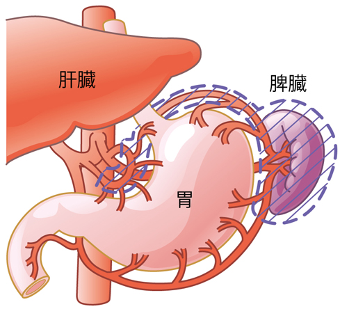 脾臓の病気 日本消化器外科学会