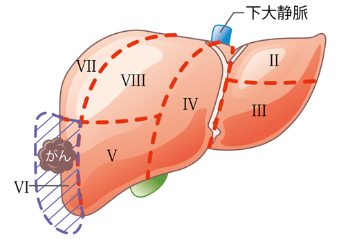 肝臓の病気 日本消化器外科学会